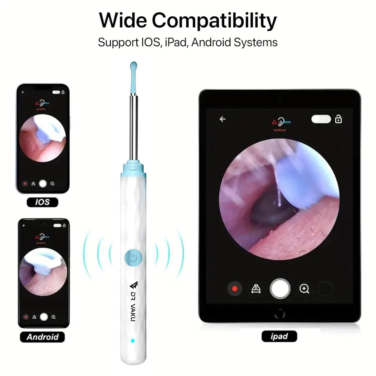 Smart Visual Ear Wax Cleaner – See, Clean &amp; Care with Confidence 👂